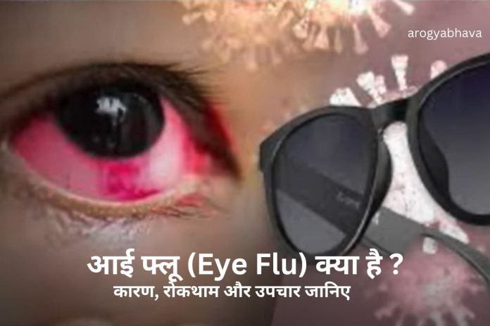 Eye Flu: आई फ्लू के कारण, रोकथाम और उपचार जानिए