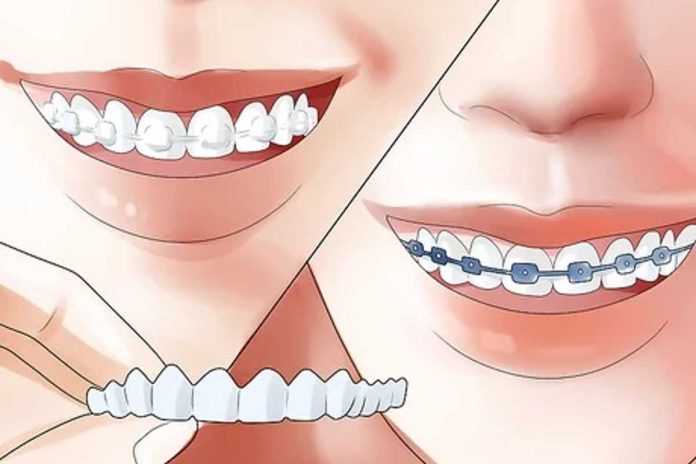 Best Ways to Straighten Your Teeth