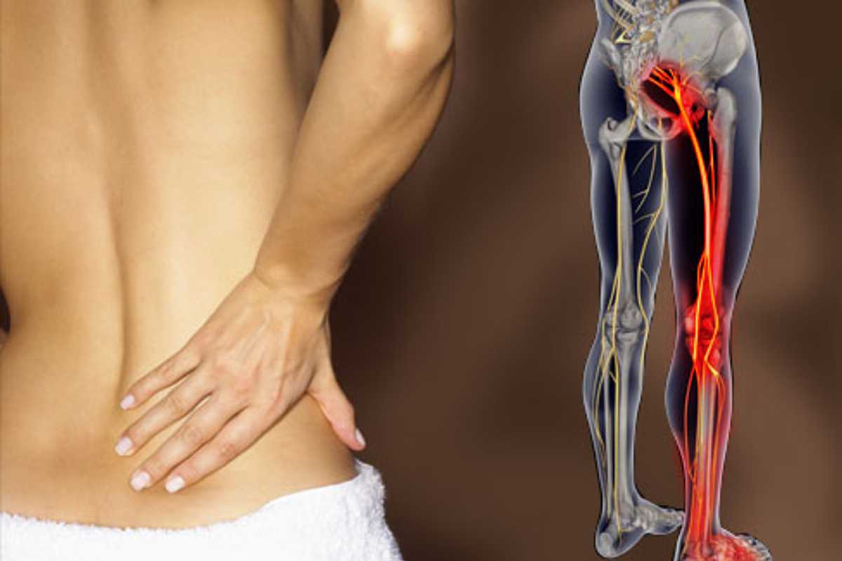 Leg and Back Pain: Is My Back Pain Related To My Leg Pain?