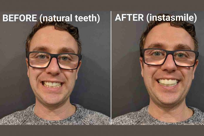 Natural Teeth Whitening : What to Watch Out For