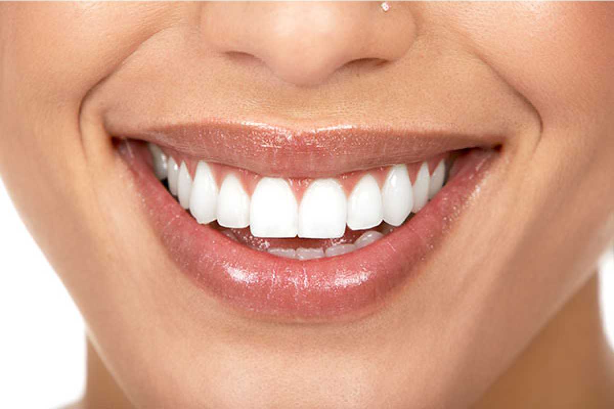 Teeth Whitening: The Important Facts You Need To Know
