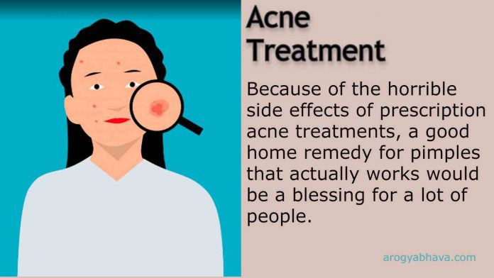 Home Remedies Treatment Of Acne