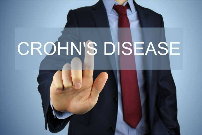 Crohn’s Disease - Symptoms and Treatment