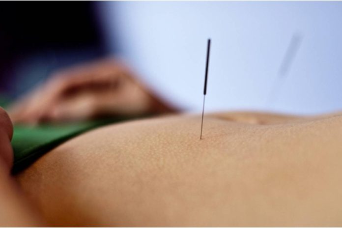 Is it possible to Lose Weight with Acupuncture?
