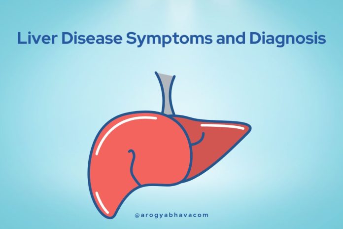 Liver Disease Symptoms and Diagnosis