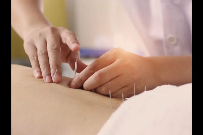 What is Acupuncture and why is it Used?