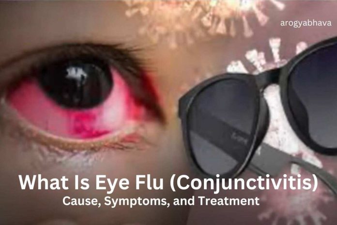 Conjunctivitis: A Comprehensive Guide to Understanding, Preventing, and Treating