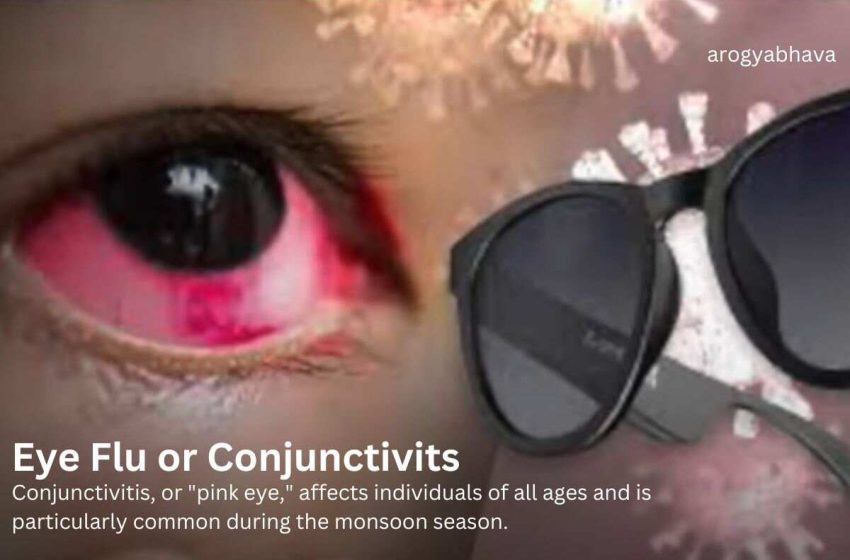  Eye Flu: An In-Depth Guide to Prevent Conjunctivitis